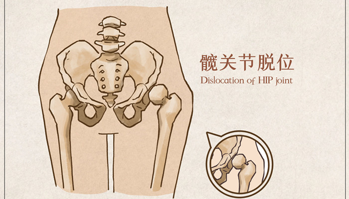 胯部在哪 胯部在哪个地方