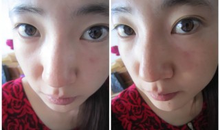 鼻子变挺的方法按摩（鼻子变挺的方法按摩图解）