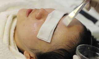 如何改善面部红血丝 如何改善面部红血丝的问题