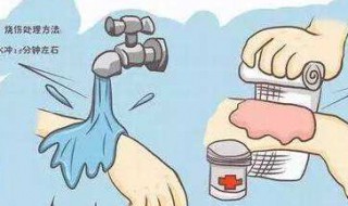 被烫了怎么办 手指被烫了怎么办