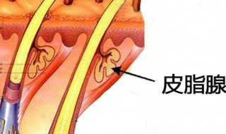 皮脂腺分泌旺盛怎么办