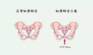 耻骨在哪个位置（耻骨在哪个位置的图片）