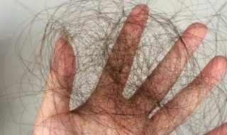 防脱发小窍门 防脱发小窍门有哪些