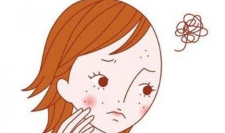 怎样祛除青春痘 怎样祛除青春痘疤痕