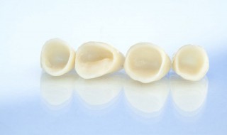 烤瓷牙种类（金属烤瓷牙种类）