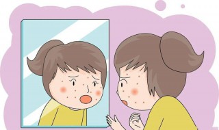 怎么正确祛除痘痘 怎样快速祛除痘痘