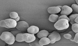 乙烯有什么作用（乙烯有什么作用与功效）