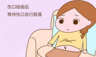 伤疤怎么去除 环世界伤疤怎么去除