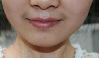 女生如何淡化唇毛 女生唇毛怎么去改善