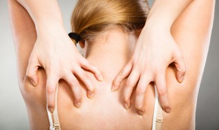 晒脱皮了怎么办 皮肤被晒脱皮了怎么办