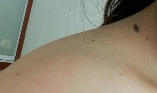 锁骨上有痣代表什么（男人锁骨上有痣代表什么）
