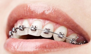 牙齿正畸仅仅是为了好看吗 牙齿正畸仅仅是为了好看吗?支付宝