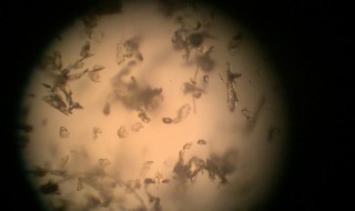 户尘螨是什么东西 粉尘螨是什么东西