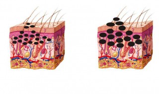 怎样才能祛斑 怎样才能祛斑斑的正确方法