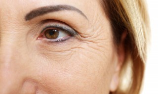 治鱼尾纹的方法 治鱼尾纹的方法有哪些