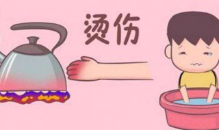 被火烫了怎么解决 被火烫了怎么办?