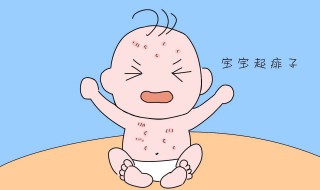 宝宝长痱子用什么擦好 宝宝长痱子用什么擦好得快