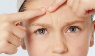 长痘的原因都有些什么 长痘的原因都有些什么症状