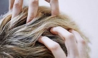 头发多久洗一次比较好 男生头发多久洗一次比较好