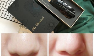 黑头一直不挤会怎样 黑头怎么去除最有效