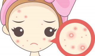 痘印怎么去除最有效（痘印怎么去除最有效的药）