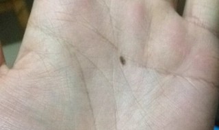 掌心有痣代表什么 女生掌心有痣代表什么