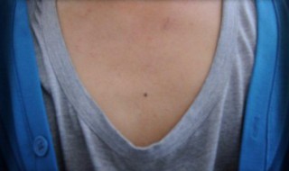 胸前有痣代表什么（胸前有痣代表什么图解）