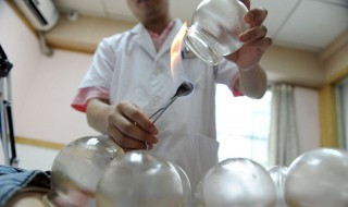 拔罐出水泡怎么回事（拔罐出水泡怎么回事可以刺破吗）
