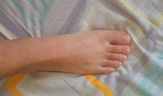 希腊脚的女人代表什么（希腊脚的女人的命运）