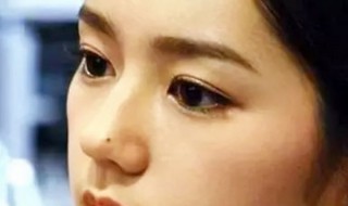 人脸上哪些痣不能点掉 面部10处恶痣是什么必须点掉