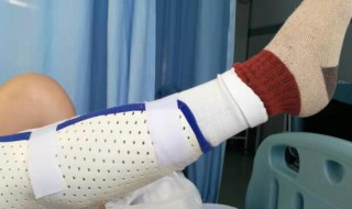 骨折能吃鸡蛋吗（脚趾骨折能吃鸡蛋吗）