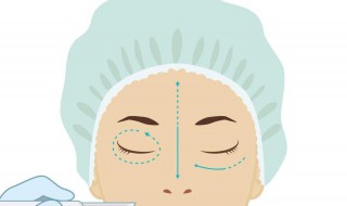 怎样能除去眼袋 怎样能除去眼袋和皱纹