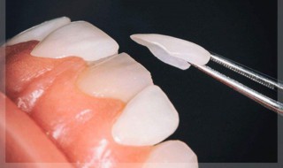 美白牙齿最有效的方法 美白牙齿小妙招