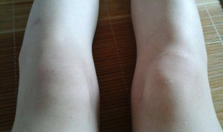 让膝盖变瘦的方法 如何让膝盖变瘦