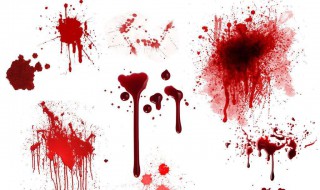 内衣血渍怎么去除（内衣去血渍的方法 妙招）