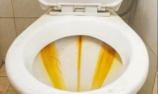 马桶壁污垢怎么去除 马桶壁污渍