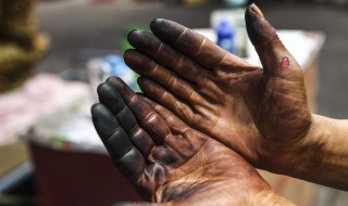 剥核桃皮手黑了怎么办（剥核桃皮把手弄黑了拿什么能去掉）