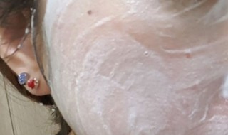 怎样去掉脸上的青春痘 怎样去掉脸上的青春痘和黑头