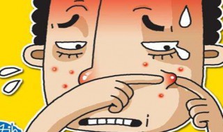 挤完痘痘后怎样消除红肿（挤完痘痘后怎样消除红肿可以用红霉素软膏）