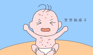 去痱子的最快方法（消除痱子的小妙招）