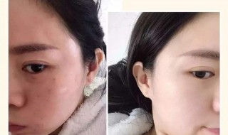 天生的黑皮肤如何变白 天生的黑皮肤如何变白的简单方法