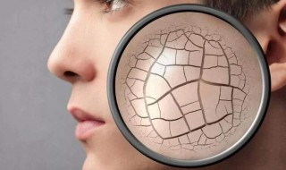 皮肤干燥的原因有哪些 皮肤干燥的原因有哪些?