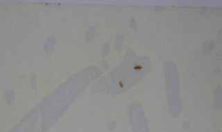 尘虱最简单的去除方法 墙壁上有好多微小的虫子