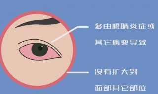 右眼跳代表什么 下午6点多右眼跳代表什么