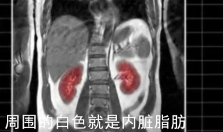 怎么知道是不是内脏脂肪多（如何判断内脏脂肪多）