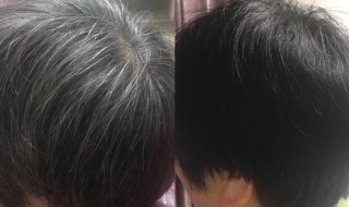 天然染黑发的方法 天然染黑发的方法是什么