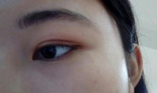 怎样贴双眼皮贴 怎样贴双眼皮贴最隐形