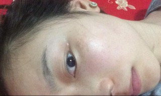 斑怎样才能清除 斑怎么去除简单方法