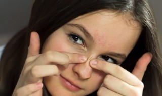 什么是酒糟鼻（什么是酒糟鼻图片）