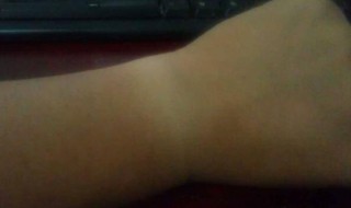 皮肤被太阳晒黑了怎么才能变白（太阳把皮肤晒黑了怎么办）